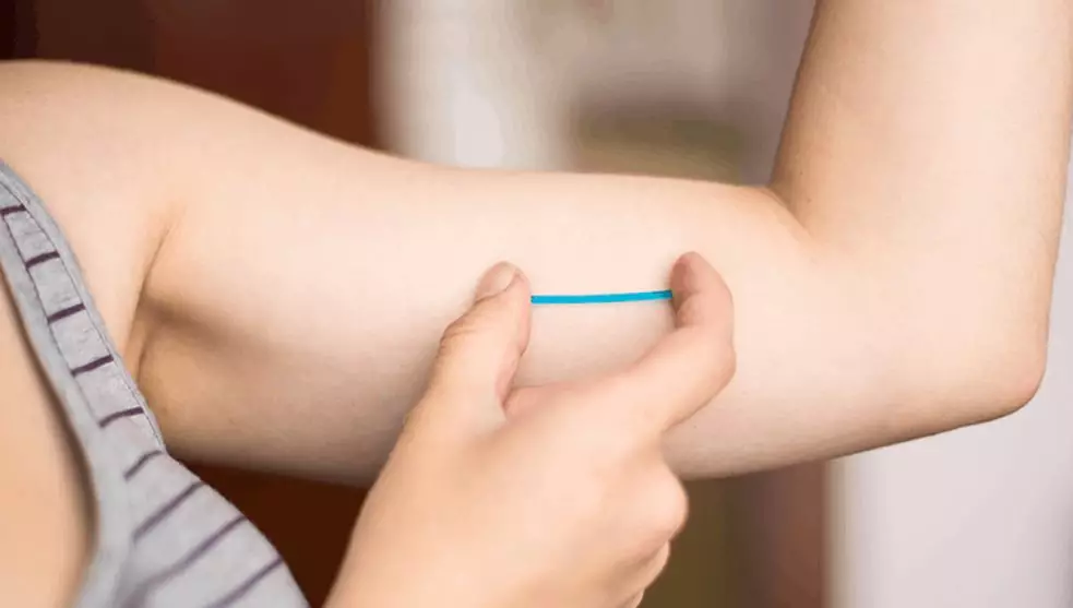 ¿Qué se siente traer un implante hormonal?