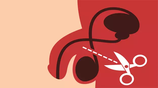 Vasectomía: “Adiós erecciones” y otros mitos